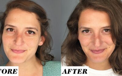 How Water Helps Skin